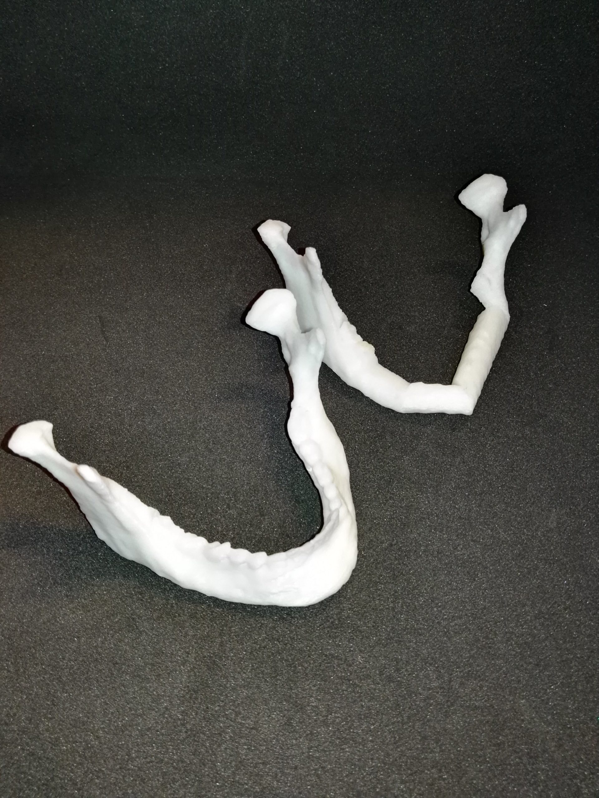 3D Printed Lower Jaw