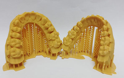 3D Printed Dental Models