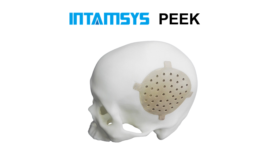 PEEK 3d printing head implant